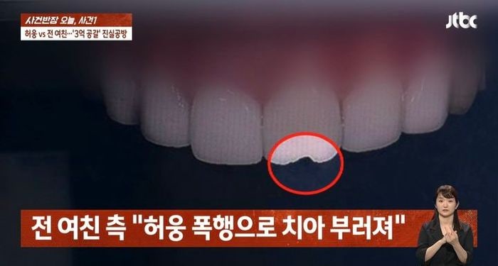 <b>허웅</b> 전 <b>여친</b> "폭행에 치아 부러져…강제 성관계도" 주장