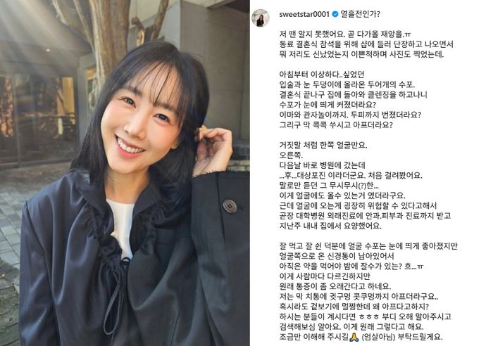 ⓒ별 SNS 갈무리