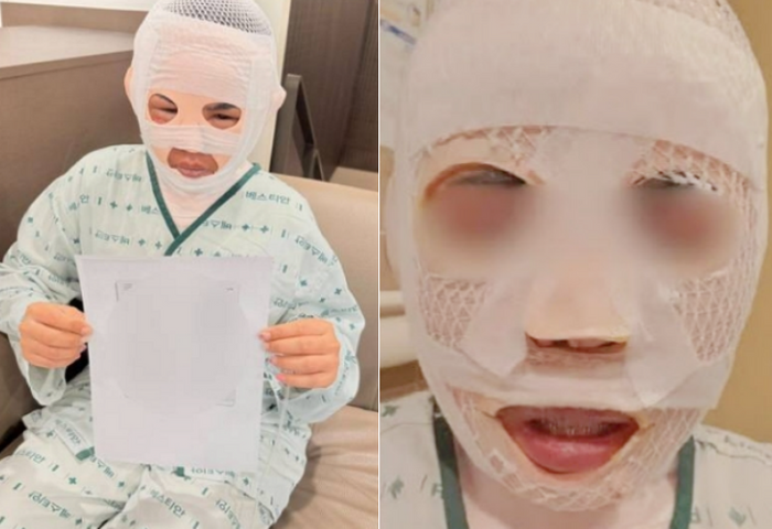 "딴 남자 만나지마" 연인 얼굴에 끓는 물 끼얹은 한국男