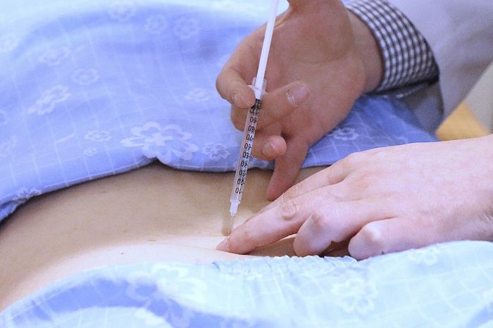 자생한방병원 의료진이 허리에 약침치료를 하고 있다 ⓒ자생한방병원