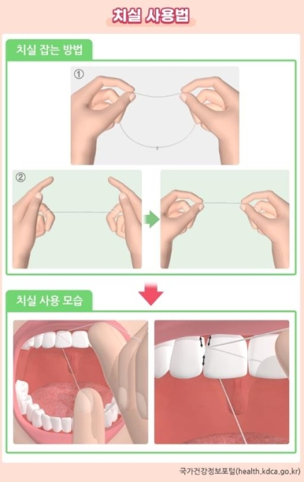 ◆…치실 사용법.