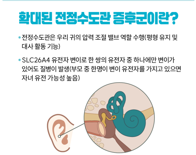 전정수도관 증후군 설명 이미지 [사진=질병관리청 홈페이지 캡쳐]