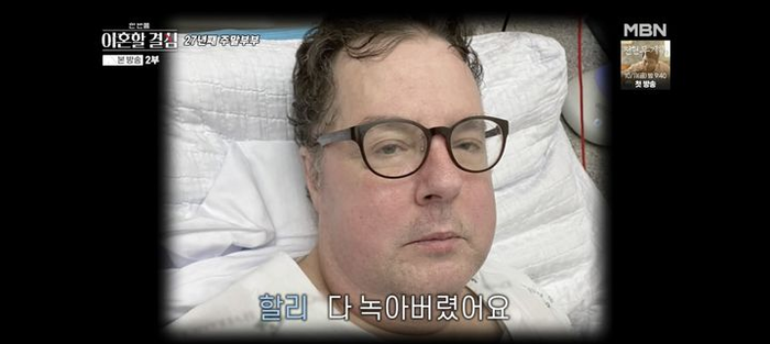 <b>로버트 할리</b>, 암투병 고백 “세계 0.1% <b>희귀암</b>, 근육 다 녹아”