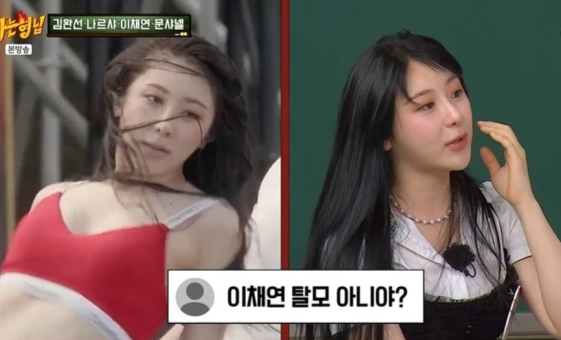 25세 <b>이채연</b>, <b>모발이식 고백</b> “워터밤 이후 탈모설 돌아” (아형)