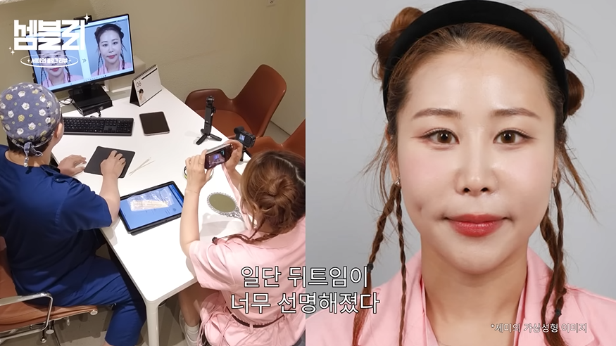 <b>박세미</b>, 문제 많던 <b>코</b>…재수술하면 이런 느낌 “고린내가 났었다”