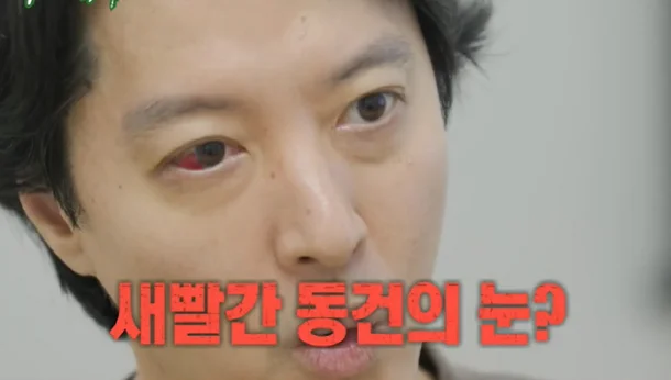 <b>이동건 희귀병</b> 진단에 母충격 “송곳으로 찌르는 느낌도”