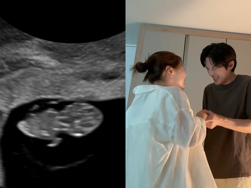 <b>김가은</b><b>윤선우</b> “아기천사가 찾아왔어요” 결혼 1주년 깜짝 <b>임신</b> 발표