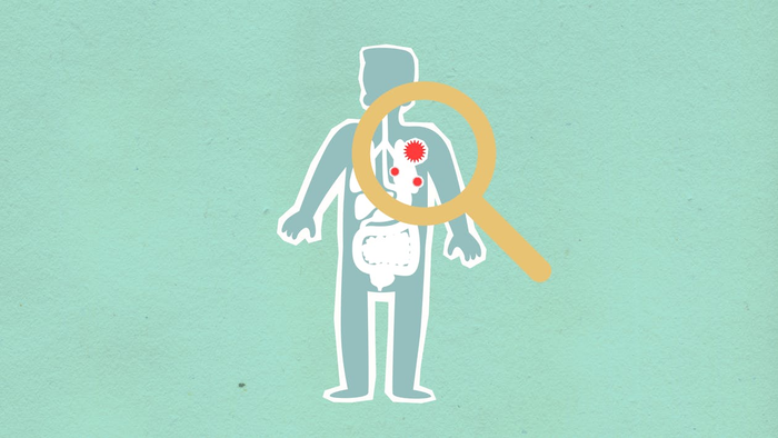 만성 염증을 의심해야 할 주요 징후 8가지는? 픽셀즈