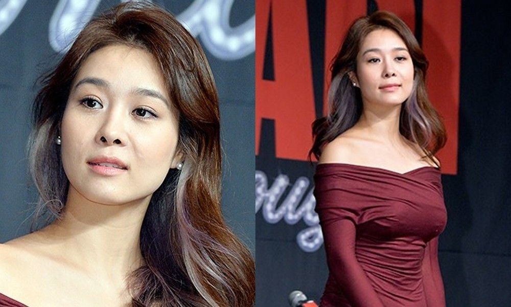 "억만금 있어도"…<b>옥주현</b>, 탈모→<b>모발이식 부작용</b> 고백 [RE:뷰]