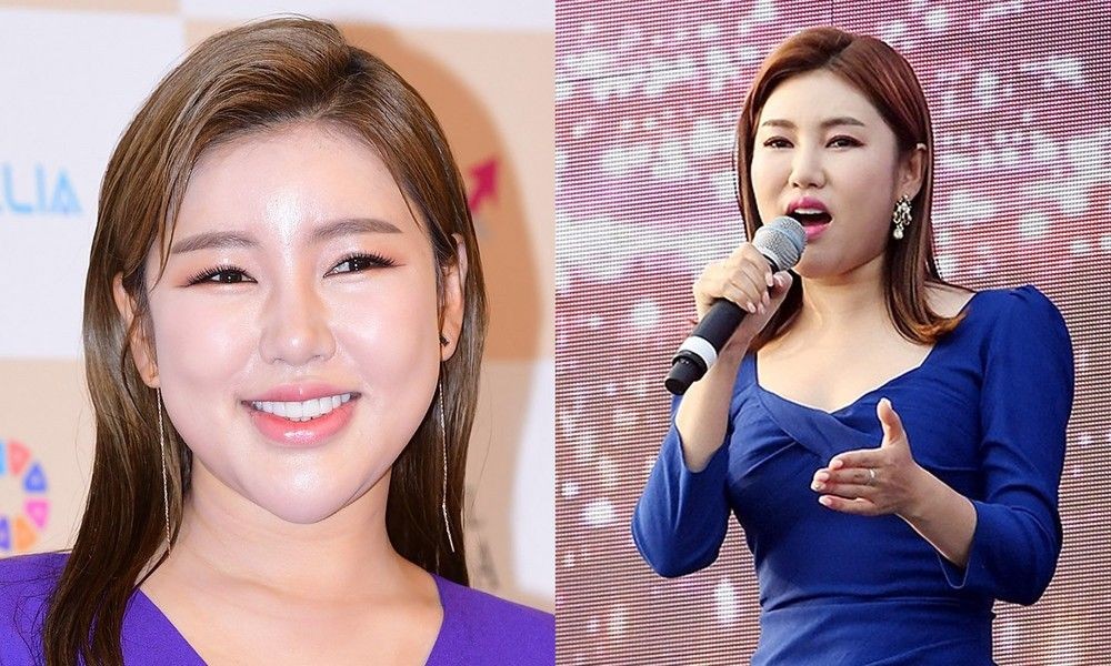 '뼈말라' <b>송가인</b>, 건강 괜찮나…대장에서 <b>용종 발견</b> "술도 안마시는데"...
