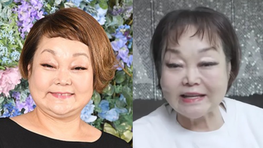 '69세' <b>이혜정</b>, 1200만 원 견적→시술 전후 비교 사진 깜짝…"만족도 200...