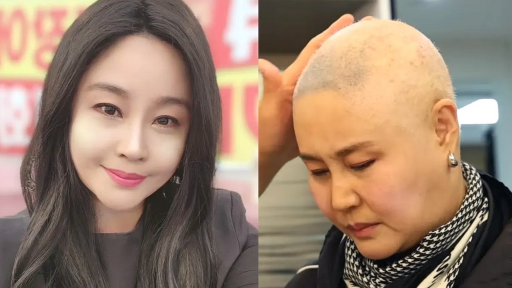 '난소암 3기' <b>홍주</b>, 2차 항암 후 열꽃→고열에 고통…"죽다 살아나 미칠...