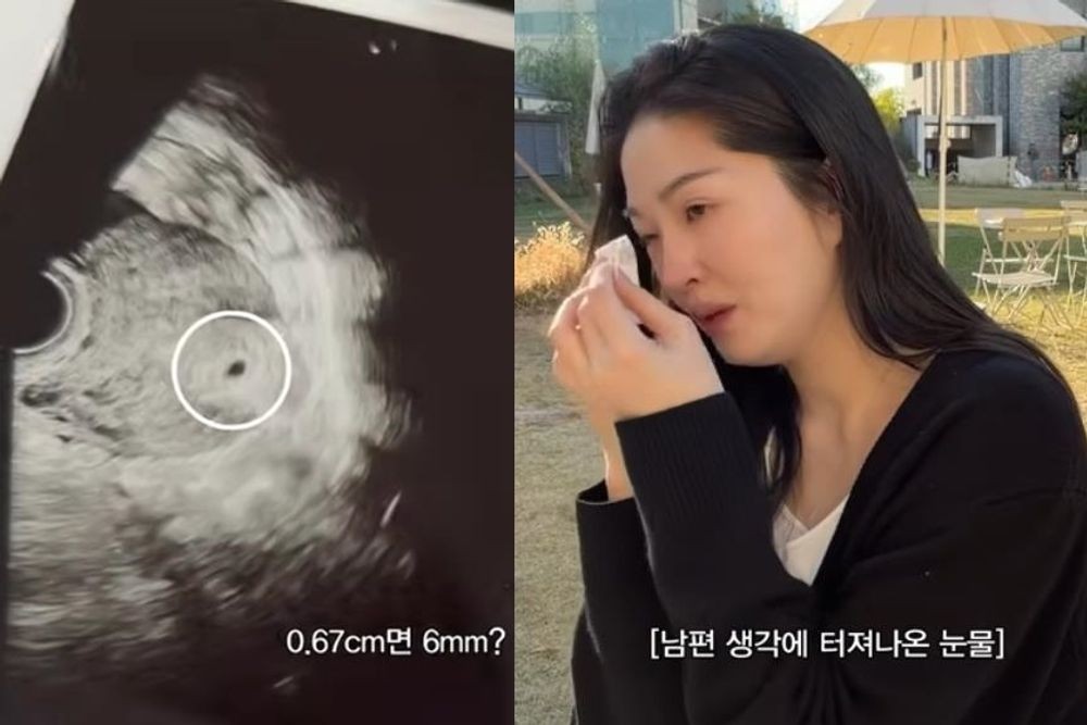 '전진' <b>류이서</b>, <b>시험관 임신</b> 7주 차에 <b>유산</b>…"남편도 마음 고생해" 눈...