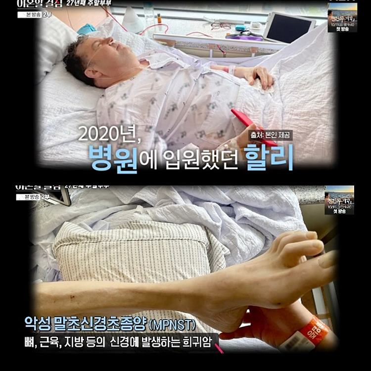 ‘마약 파문’ <b>로버트 할리</b> “<b>희귀암 투병</b>, 근육 다 녹아... 일어설 수 ...