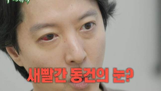 [TVis] <b>이동건</b>, <b>희귀병</b> 진단…새빨간 눈 ‘충격’(‘미우새’)