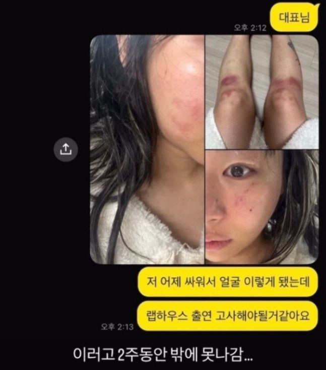 래퍼 <b>재키와이</b>, <b>데이트 폭력</b> 피해 주장… AOMG 측 “법적 절차 예정” [...