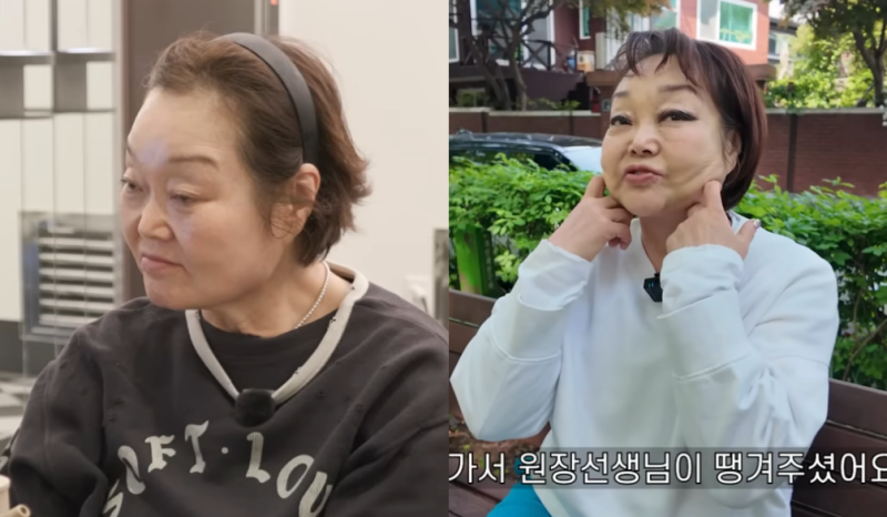 ‘빅마마’ <b>이혜정</b>, 얼굴에 실 넣고 보톡스 고백…“보수 좀 했다”