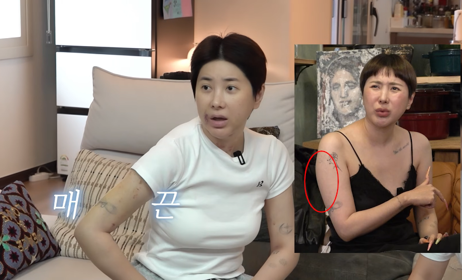 ‘코수술 5번’ <b>서인영</b>, 팔뚝 <b>지방흡입</b> 고백 “워터밤 때문…출연료 다...