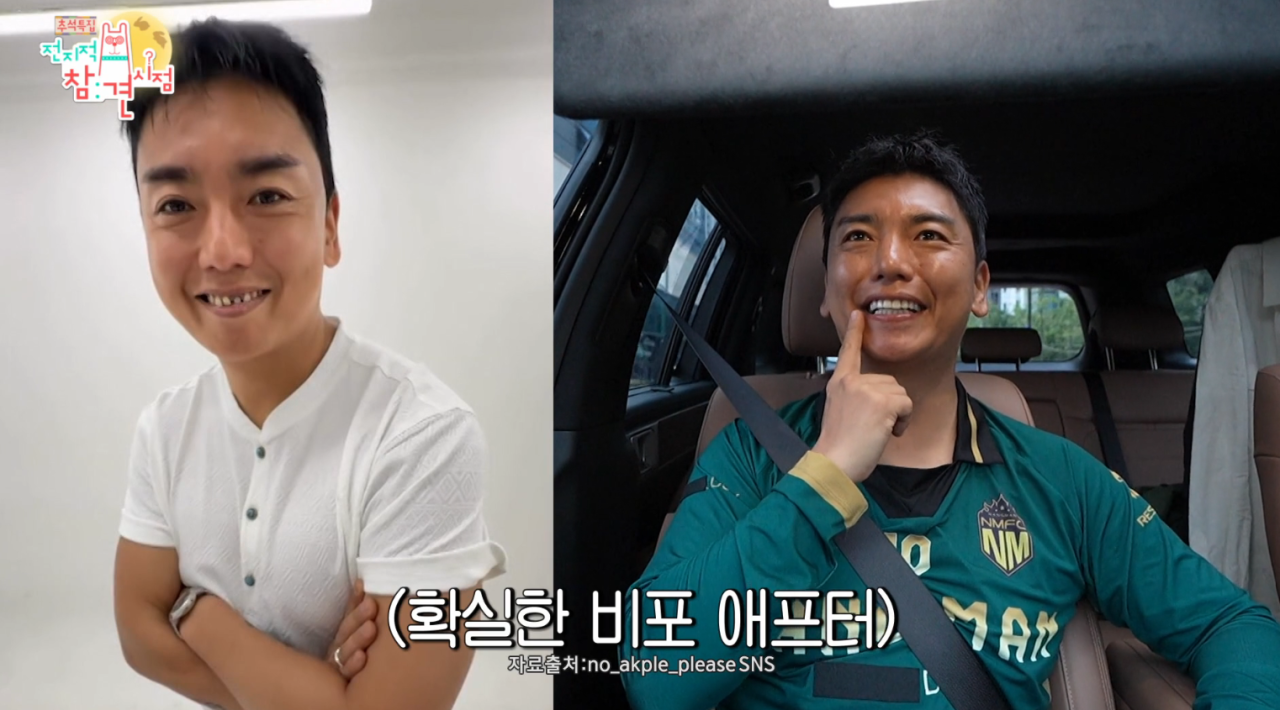 <b>곽범</b>, ‘<b>고정 8개</b>’ 될만했네 “얼굴에만 수천만원 들여” (‘전참시’...