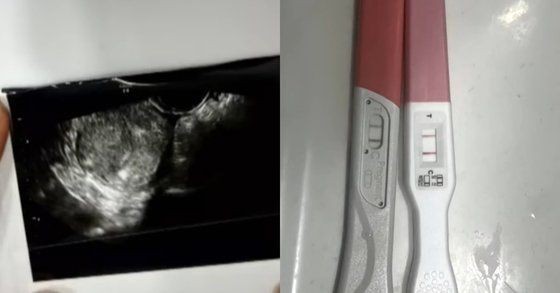 "누나 인생 망치게 한 것 같다"…'낙태 종용' <b>프로</b><b>선수</b> 녹취 공개