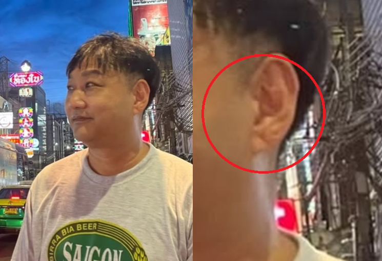 <b>김수용</b> '귓불 주름' <b>심근경색</b> 관련있나?…'슬의생' 전문가 분석 들어보...