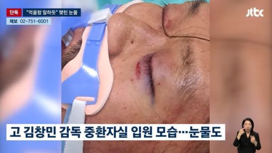 고(故) 김창민 영화감독이 폭행 피해로 입원했을 당시 사진이 공개된 가운데,<a href=