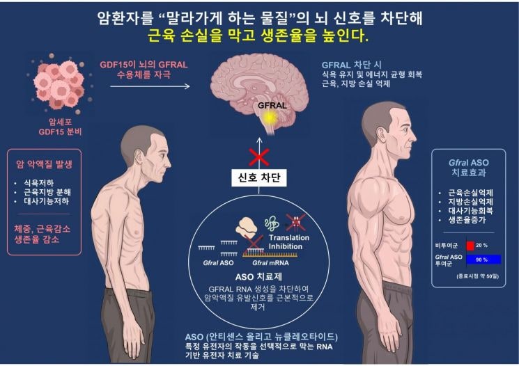 암 환자 살 빼는 진짜 범인은 '뇌'였다니