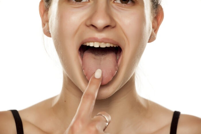 "<b>혓바닥</b> 하얗게 <b>백태</b> 잘 껴?"…놔두면 살찔 수도 있다, 왜?