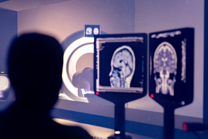10분의 자기공명영상(MRI) 검사로 발병 최대 9년 전 80%의 정확도로 치매 예측이 가능하다는 새로운 연구 결과가 나왔다. (기사와 직접적 관련 없는 자료사진)[사진=클립아트코리아]