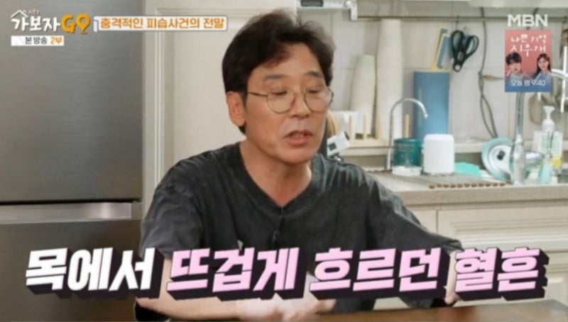 <b>조관우</b> "팬에게 <b>소주병</b>으로 목 찔려 <b>80바늘</b> 꿰매" …'이곳' 피해서 살았다는데