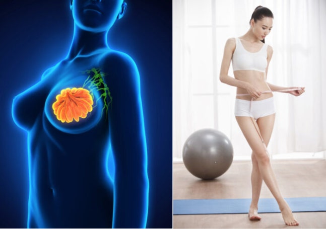 전문가들은 유방암 위험을 줄이기 위해 식습관, 운동, 체중 관리 등 다양한 요소에 신경 쓸 필요가 있다고 강조한다. [사진=게티이미지뱅크]