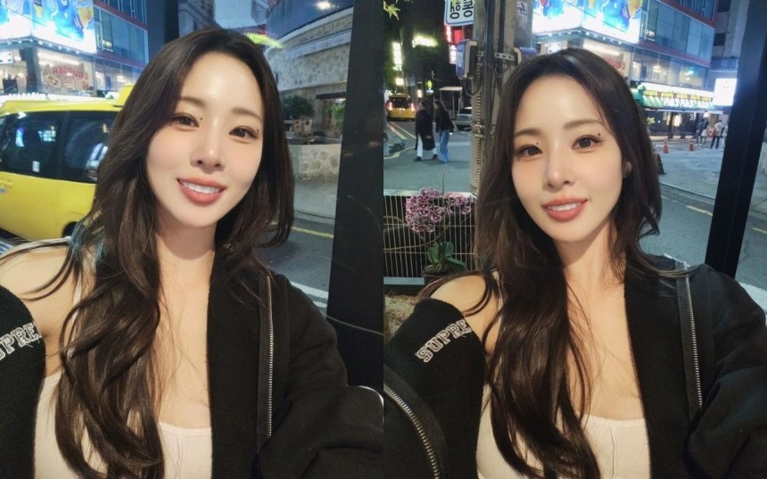제로네이트 시술 신수지 치아 변색 고민과 관리 팁0