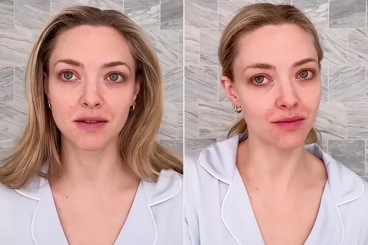 “울긋불긋 피부 뒤집어져”…美 배우 19세부터 ‘이 피부병’ 앓아, 무슨 일?