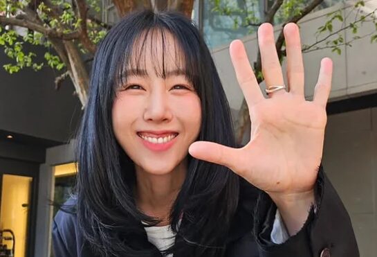 가수 별이 얼굴에 대상포진이 생긴 사실을 고백했다.[사진=별 인스타그램]