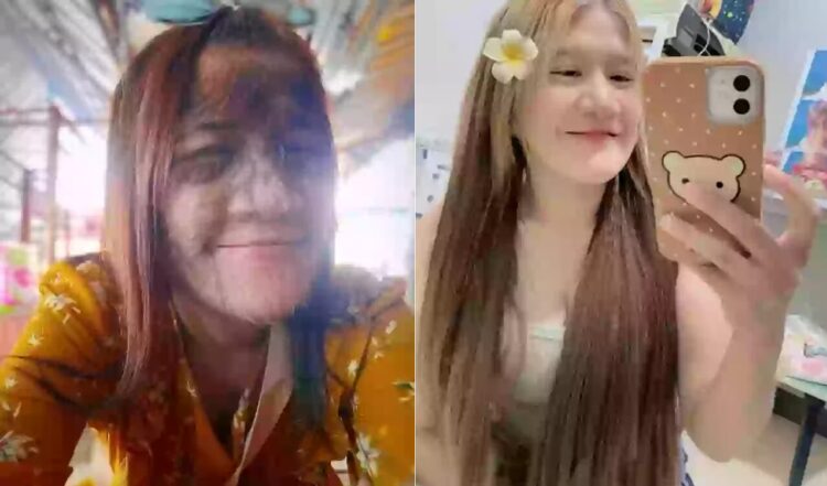 '늑대소녀'라 불리던 20대 태국 여성이 최근 털을 모두 없앤 근황이 화제다.[사진=SNS]
