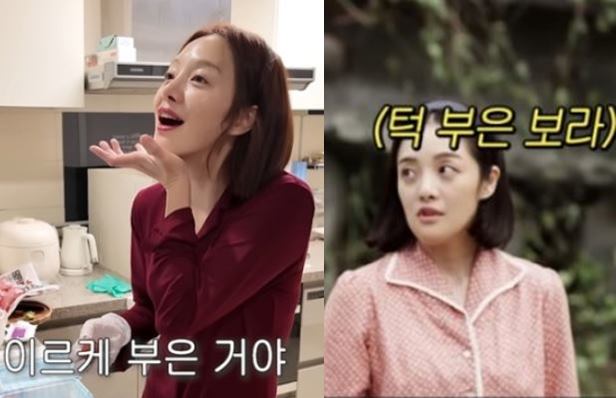 황보라가 턱 필러 시술을 받고 심한 부기를 경험했다고 말했다.사진=황보라 유튜브 채널 영상 캡처