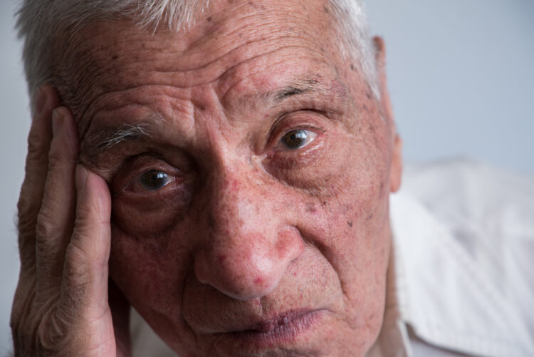 치매는 기억력과 인지 기능이 점진적으로 저하되는 뇌 질환으로,전 세계적인 고령화로 인해 환자 수가 급증하고 있으며 그 중 알츠하이머가 가장 흔한 원인이다.사진=게티이미지뱅크