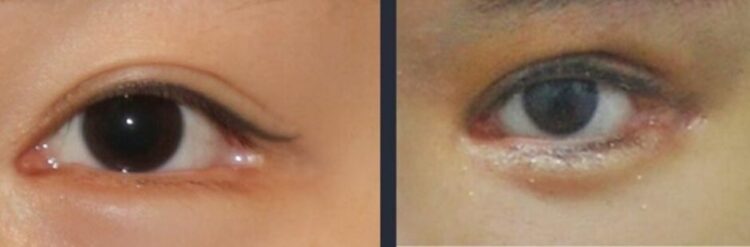 어색하게 내려놓은 눈꼬리들