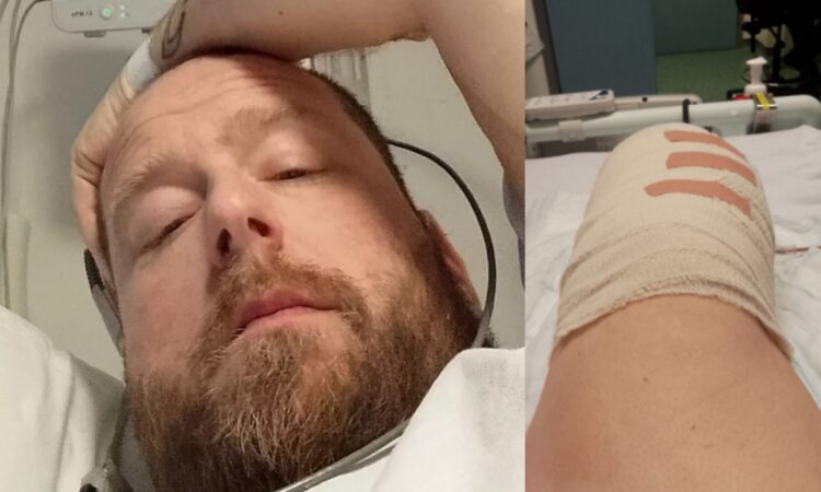 발가락에 생긴 물집 때문에 병원을 찾았던 40대 남성이 불과 24시간 만에 하퇴(무릎 아래부터 발목까지의 다리 부위) 절단 수술을 받은 사연이 공유됐다 사진=고펀드미