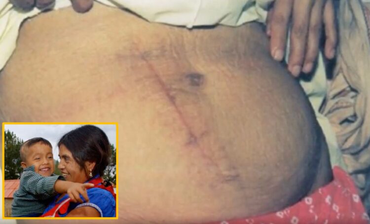 사람이 스스로 자신의 복부와 자궁을 절개해 아이를 꺼내고,그 과정에서 치명적인 출혈이나 장기 손상 없이 생존하는 것이 가능할까.사진=International Journal of Gynecology 