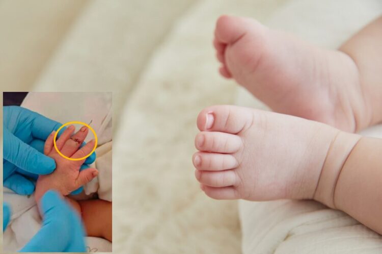 중국의 한 병원에서 제왕절개 수술 도중 조산사가 탯줄을 자르다 신생아의 손가락을 절단하는 사고가 발생했다.배경사진=게티이미지뱅크/왼쪽 하단 사진=베이징뉴스