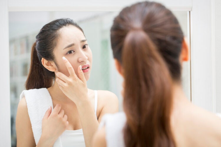 거울 앞에서 뾰루지나 여드름 부위를 손으로 만지거나 짜는 습관은 피부과에서 가장 강하게 말리는 행동이다.사진=클립아트코리아