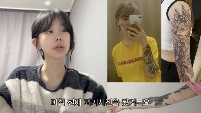 조두팔이 문신 제거 시술을 받았다.사진=조두팔 유튜브 채널 영상 캡처