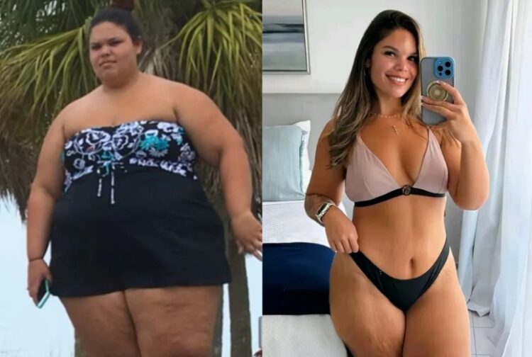 76kg 감량에 성공한 제시카 베니케즈(30)의 다이어트 전후 모습.사진=더선