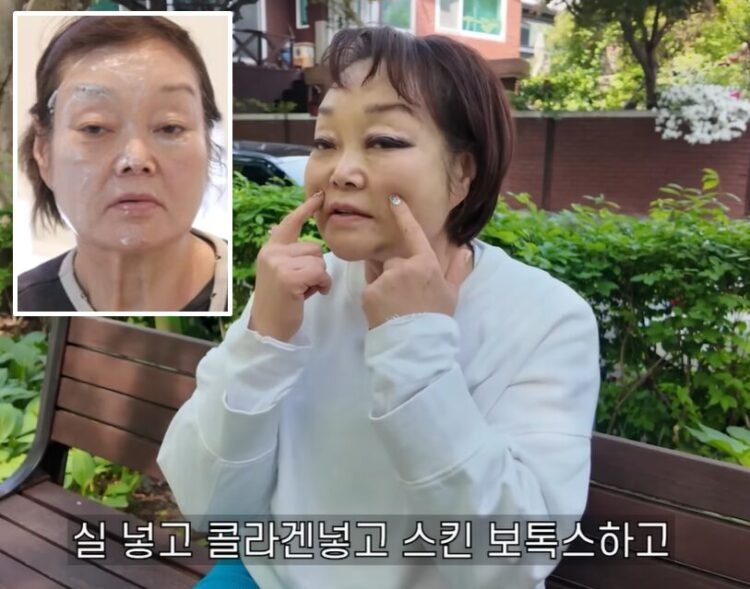‘빅마마’ <b>이혜정</b>, 팽팽해진 피부 무슨 일? “‘이 시술’ 받고 만족도...