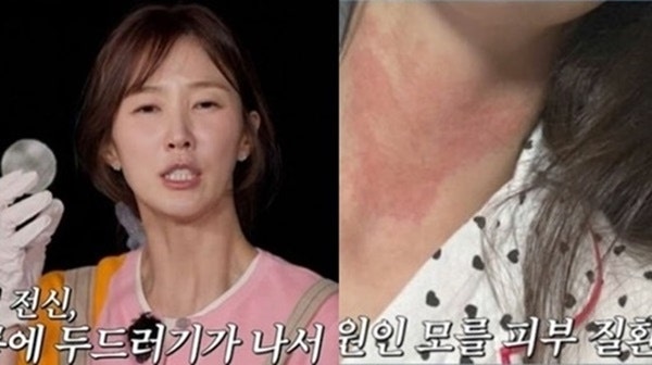 이수경 “온몸에 벌건 두드러기”…우울증·대인기피증까지, 무슨 일?