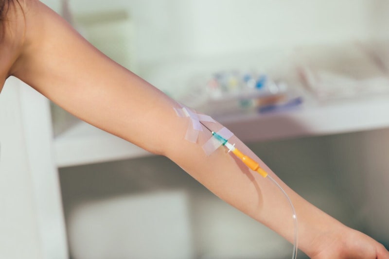 조영제, 팔에 놓았는데…20분 뒤 혈관 아닌 림프관에서 더 진했다