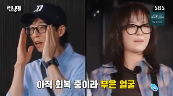 송지효, 레이저 시술 고백 송지효, 레이저 시술 고백