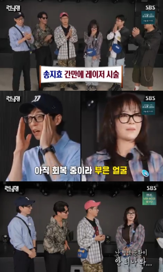 송지효, 레이저 시술 고백 송지효, 레이저 시술 고백