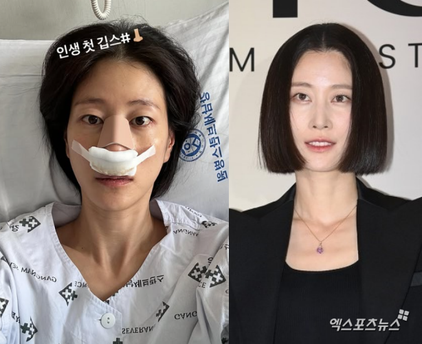 <b>이현이</b>, '안면 마비' 2년만 '<b>코뼈 골절</b>' 대형 부상…"의욕 앞서, 다행히...